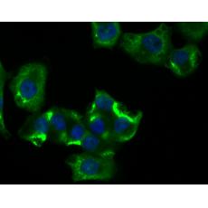 Anti-RIP3 antibody