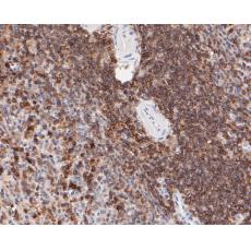 Anti-CD43 antibody
