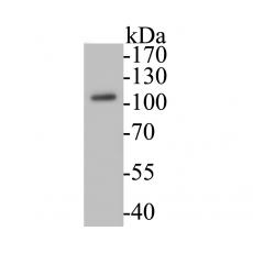 Anti-Villin1 antibody