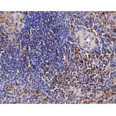 Anti-CD68 antibody