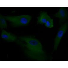 Anti-AKT3 antibody