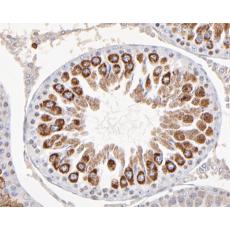 Anti-KCNAB1 antibody