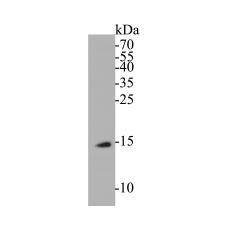 Anti-BLOS1 antibody
