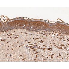 Anti-TMX1 antibody