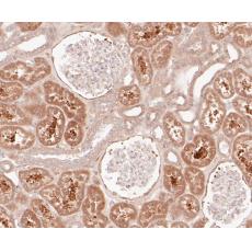Anti-BIN1 antibody