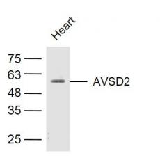Anti-AVSD2 antibody
