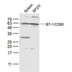 Anti-B7-1/CD80 antibody