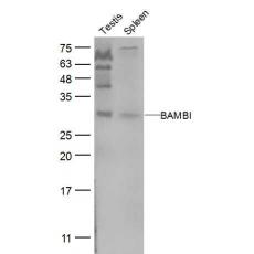 Anti-BAMBI antibody