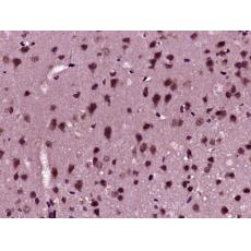 Anti-BASP1 antibody
