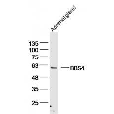 Anti-BBS4 antibody