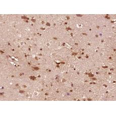 Anti-BCL2L15 antibody