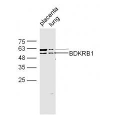 Anti-BDKRB1 antibody
