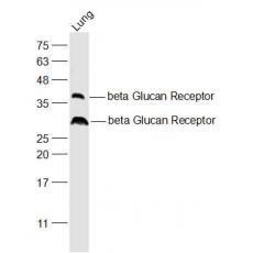 Anti-beta Glucan Receptor antibody