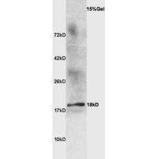 Anti-Beta-lactoglobulin antibody