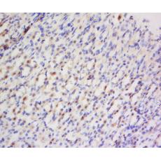 Anti-Big endothelin-1 antibody