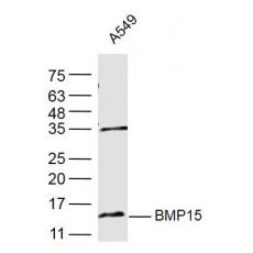 Anti-BMP15 antibody