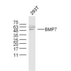 Anti-BMP7 antibody