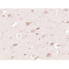 Anti-BMPER antibody