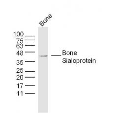 Anti-Bone Sialoprotein antibody