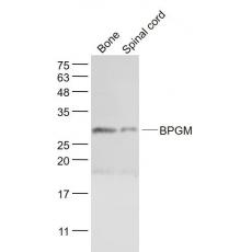 Anti-BPGM antibody