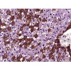 Anti-BTBD17 antibody