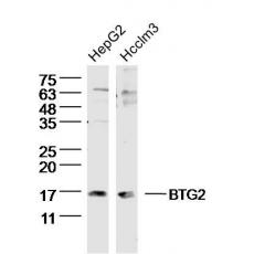 Anti-BTG2 antibody