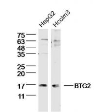 Anti-BTG2 antibody