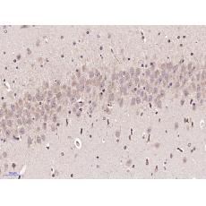 Anti-BTNL2 antibody
