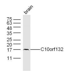 Anti-C10orf132 antibody