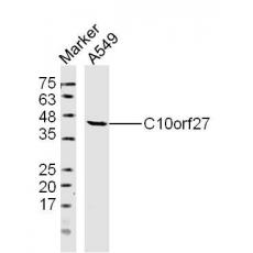 Anti-C10orf27 antibody