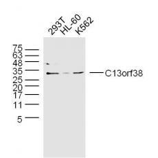 Anti-C13orf38 antibody