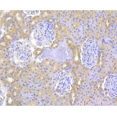 Anti-ITPR2 antibody