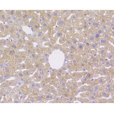 Anti-CD163 antibody