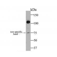 Anti-CDH17 antibody