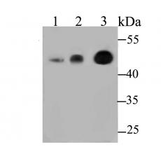 Anti-CBARA1 antibody