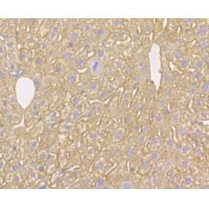 Anti-Kir6.2 antibody