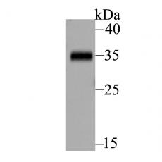 Anti-BOB1 antibody