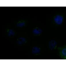 Anti-MICA + MICB antibody
