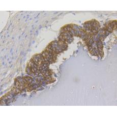 Anti-Cytokeratin 17 antibody