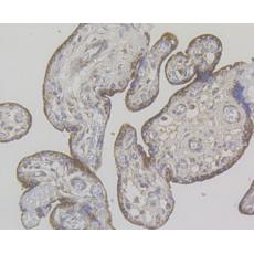 Anti-G-protein coupled receptor 30 antibody