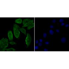 Anti-Galectin 3 antibody