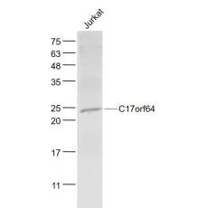Anti-C17orf64 antibody