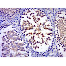 Anti-C17orf75 antibody