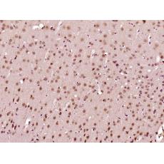 Anti-C1orf125 antibody