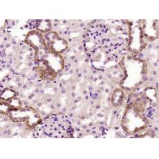 Anti-C1orf172 antibody