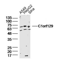 Anti-C1orf43 antibody