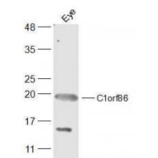 Anti-C1orf86 antibody