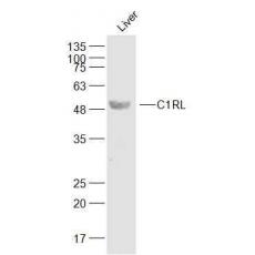 Anti-C1RL antibody