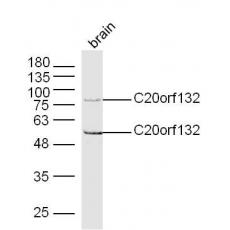 Anti-C20orf132 antibody
