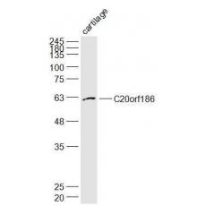 Anti-C20orf186 antibody